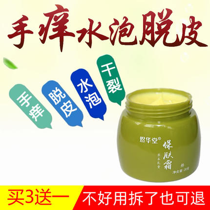 手痒膏脱皮干裂修复乳膏角化型手痒起小水泡手气足痒消疹草本清肤