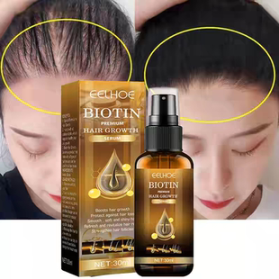 BIOTIN HAIR GROWTH SERUM 生物素头发护发喷雾郝优