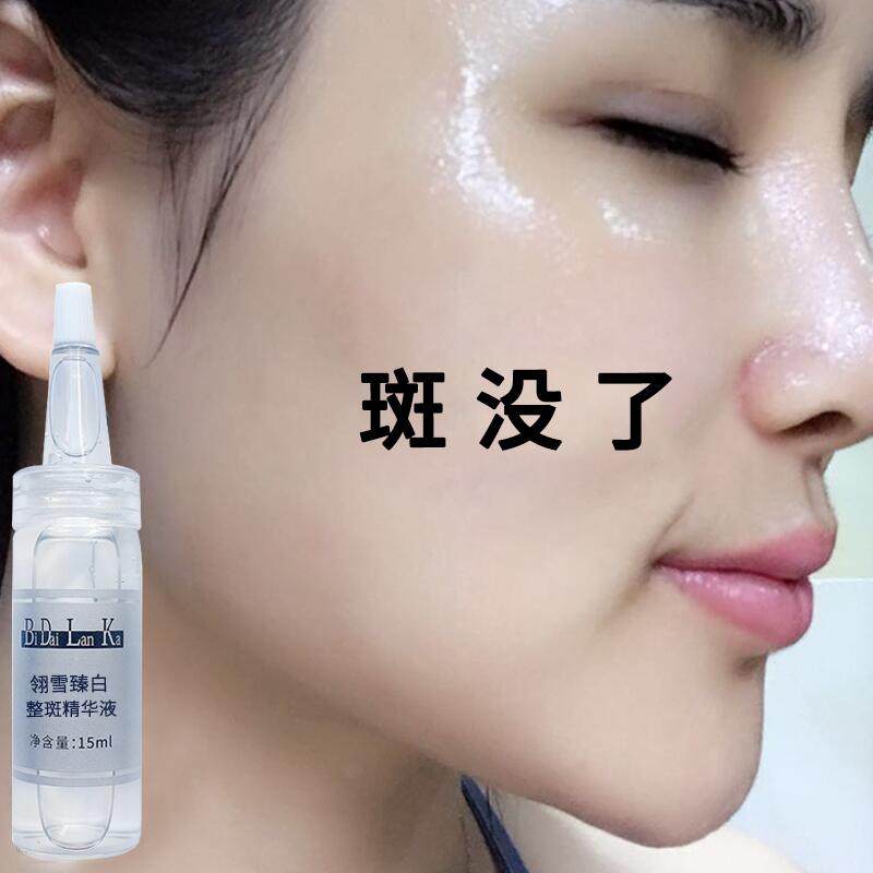 【158三瓶一疗程】祛除脸上小黑点斑点 净颜洁面精油 白净好脸色
