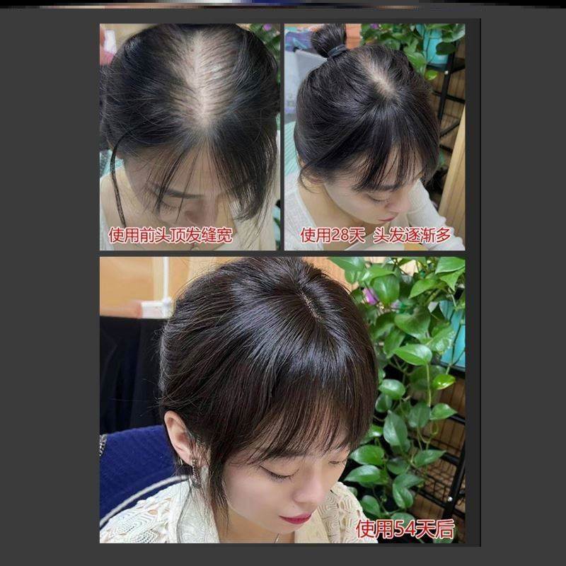 防脱生发育发液排行榜第一名旗舰店净彻控油精华黄韩国发际线粉
