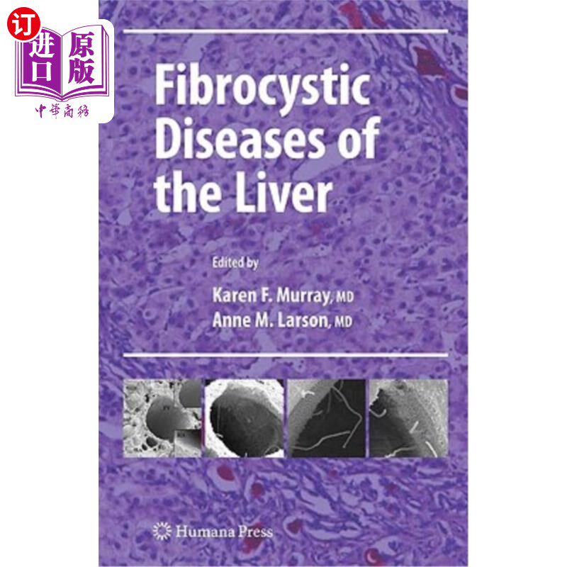 海外直订医药图书Fibrocystic Diseases of the Liver 肝脏纤维囊性疾病
