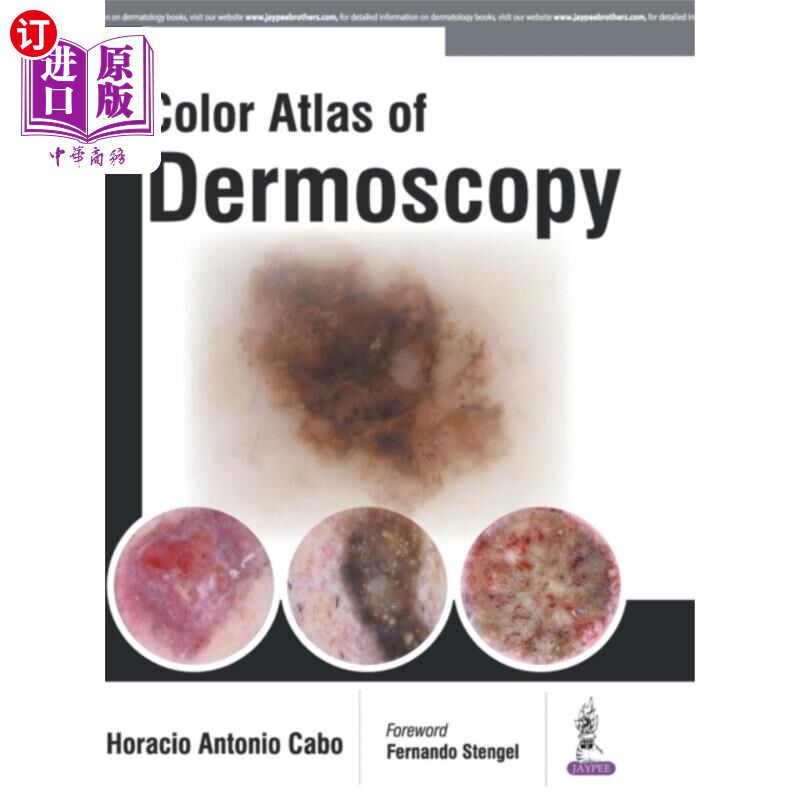 海外直订医药图书Color Atlas of Dermoscopy 皮肤镜彩色图谱