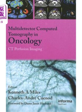 海外直订医药图书Multi-Detector Computed Tomography in Oncology: CT Perfusion Imaging 肿瘤学中的多检测器计算机断层扫