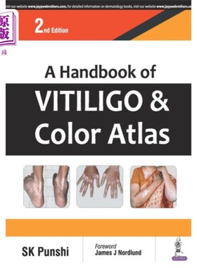 海外直订医药图书Handbook of Vitiligo & Color Atlas 白癜风彩色图集手册
