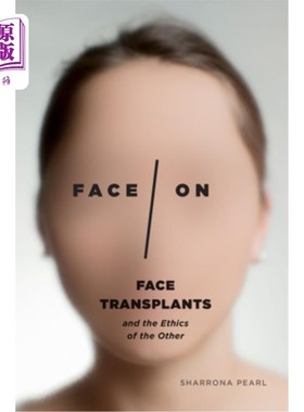 海外直订医药图书Face/On: Face Transplants and the Ethics of the Other Face/On: Face transplant and the