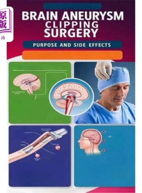 海外直订医药图书Brain Aneurysm Clipping Surgery Purpose and Side Effects: Brain aneurysm clippin 脑动脉瘤夹闭手术的