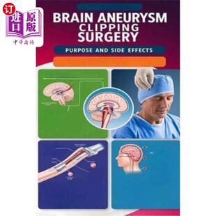 海外直订医药图书Brain Aneurysm Clipping Surgery Purpose and Side Effects: Brain aneurysm clippin 脑动脉瘤夹闭手术的