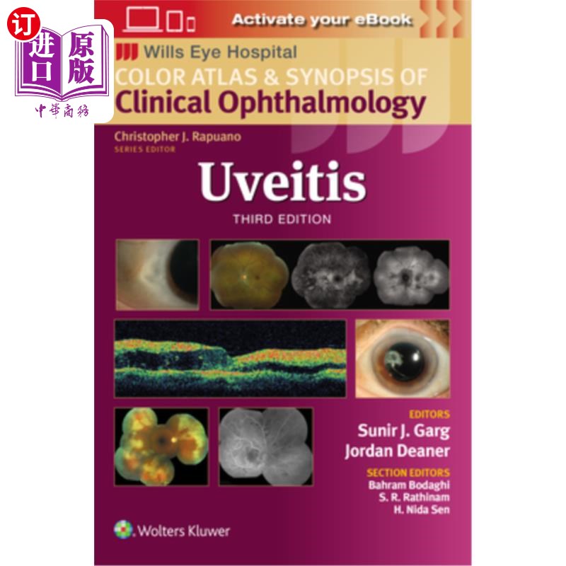 海外直订医药图书Uveitis 葡萄膜炎