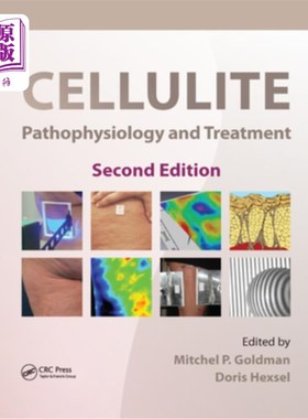 海外直订医药图书Cellulite: Pathophysiology and Treatment 脂肪团:病理生理与治疗