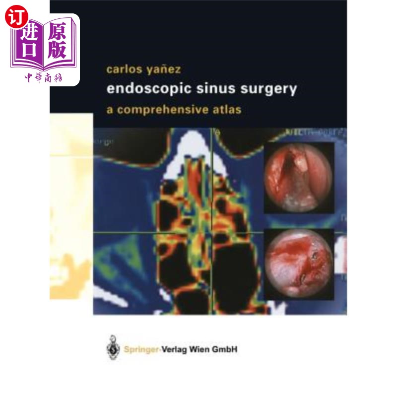 海外直订医药图书Endoscopic Sinus Surgery: A Comprehensive Atlas 鼻内窥镜手术:综合图谱