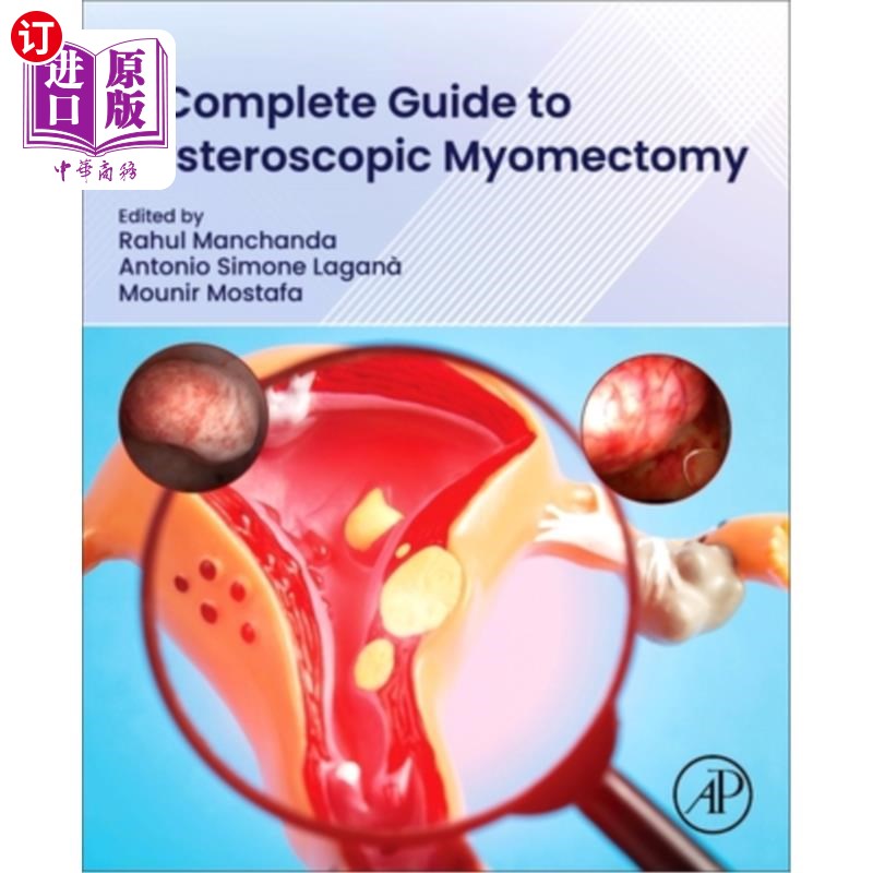 海外直订A Complete Guide to Hysteroscopic Myomectomy 宫腔镜子宫肌瘤切除术的完整指南