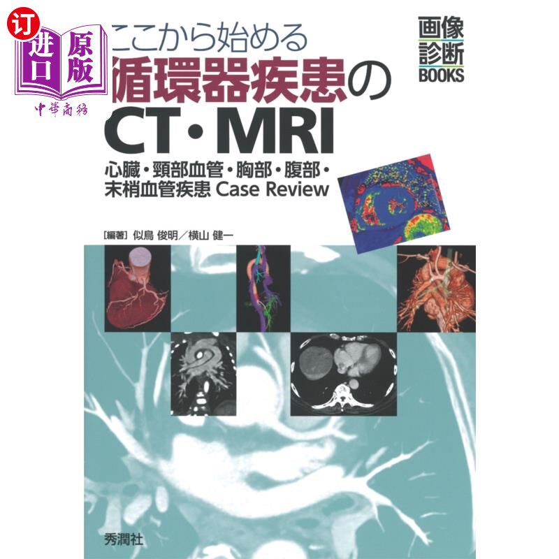 海外直订日语 ここから始める循環器疾患のＣＴ・ＭＲＩ　心臓・頸部血管・胸部・腹部・末梢血管疾患Ｃａｓｅ　Ｒｅｖｉｅｗ