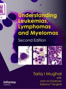 海外直订医药图书Understanding Leukemias, Lymphomas and Myelomas 了解白血病、淋巴瘤和骨髓瘤