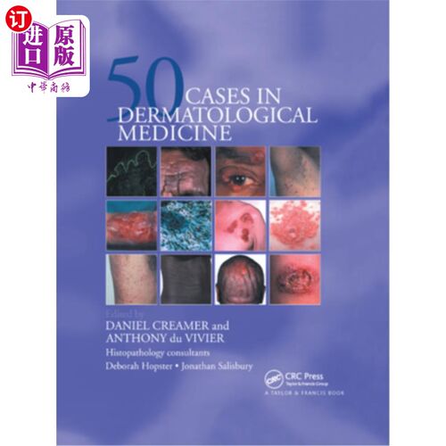 海外直订医药图书Fifty Dermatological Cases 皮肤病50例