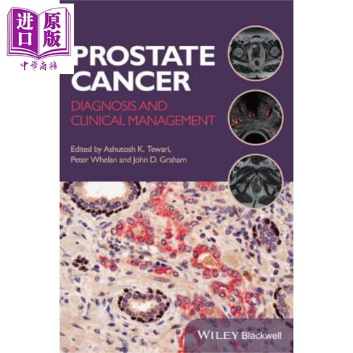 现货 前列腺癌 诊断与临床管理 Prostate Cancer Ashutosh Tewari 英文原版 中商原版 Wiley【中商原版】
