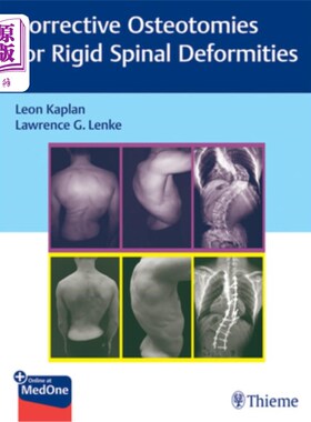 海外直订医药图书Corrective Osteotomies for Rigid Spinal Deformities 刚性脊柱畸形的矫正截骨术