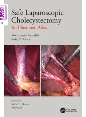 海外直订医药图书Safe Laparoscopic Cholecystectomy 安全的腹腔镜胆囊切除术