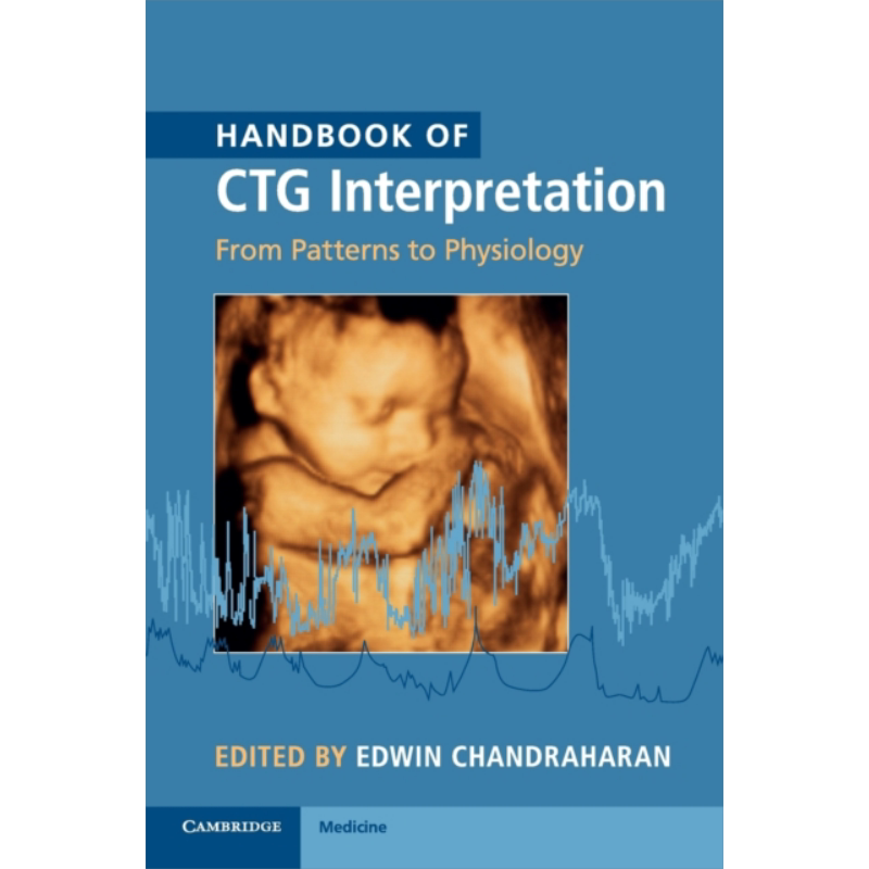 现货 Handbook of CTG Interpretation 英文原版 CTG解读手册 从模式到生理学 剑桥大学出版社 Edwin Chandraharan【中商原版】