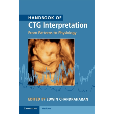 现货 Handbook of CTG Interpretation 英文原版 CTG解读手册 从模式到生理学 剑桥大学出版社 Edwin Chandraharan【中商原版】
