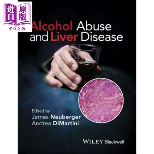 现货 酒精滥用与肝脏疾病 Alcohol Abuse And Liver Disease James Neuberger 【中商原版】Wiley