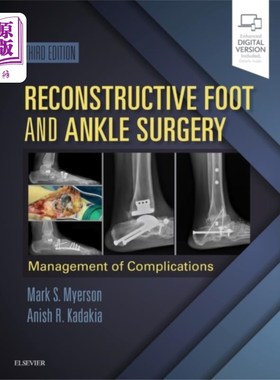 海外直订医药图书Reconstructive Foot and Ankle Surgery: Managemen... 足踝重建手术:并发症的处理