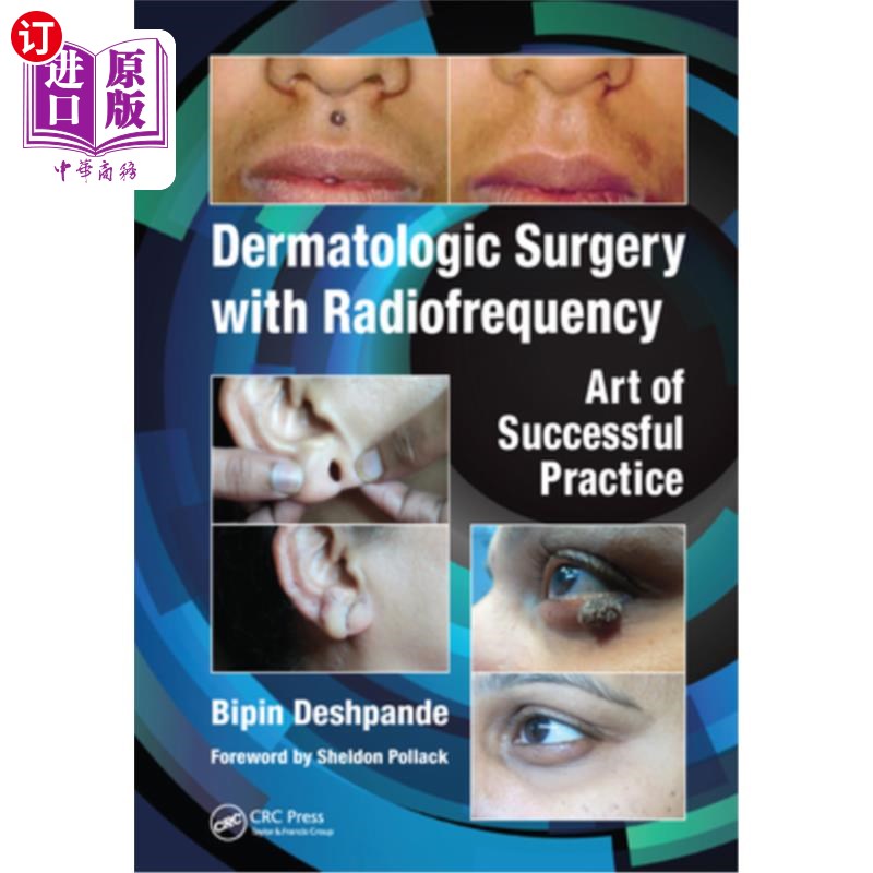 海外直订医药图书Dermatologic Surgery with Radiofrequency: Art of Successful Practice 射频皮肤外科:成功实践的艺术
