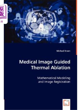 海外直订医药图书Medical Image Guided Thermal Ablation 医学影像引导热消融