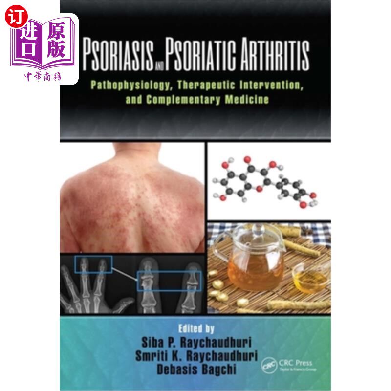 海外直订医药图书Psoriasis and Psoriatic Arthritis: Pathophysiology, Therapeutic Intervention, an 牛皮癣和银屑病关节