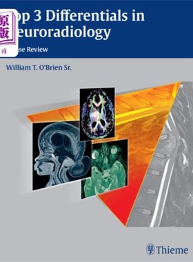 海外直订医药图书Top 3 Differentials in Neuroradiology 神经放射学前3名