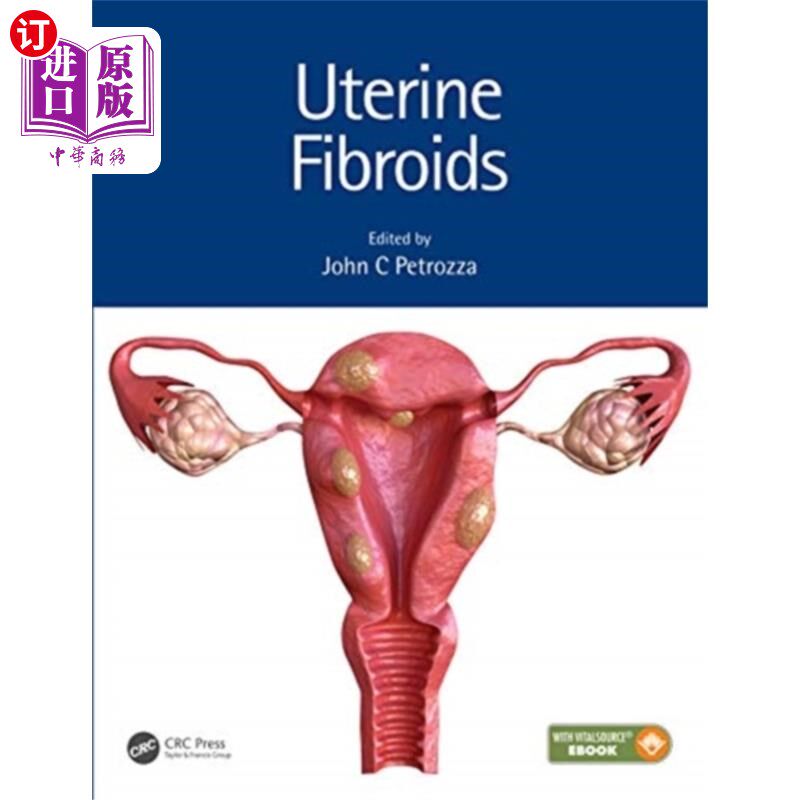 海外直订医药图书Uterine Fibroids 子宫肌瘤