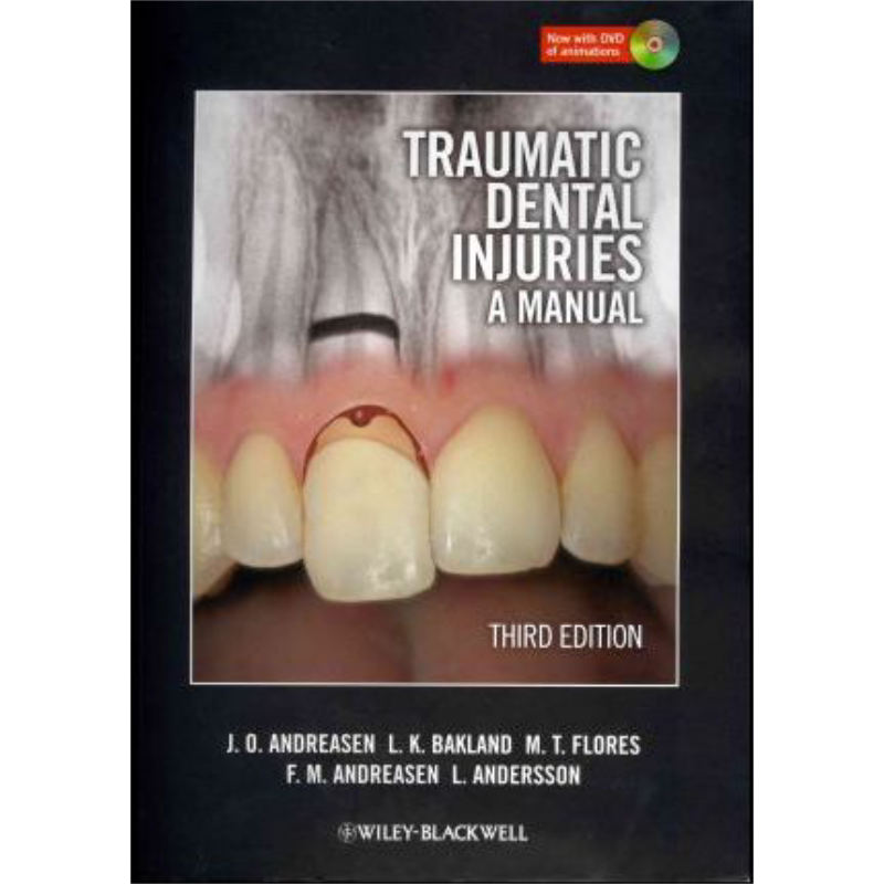 现货 Traumatic Dental Injuries A Manual 3E 英文原版 创伤性口腔损伤手册 第三版 Jens Andreasen【中商原版】