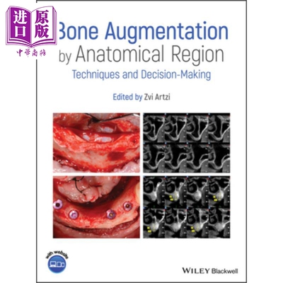 现货 解剖区域的骨增强 技术与决策 Bone Augmentation By Anatomical Region 英文原版 Zvi Artzi 中商原版