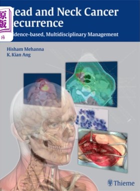 海外直订医药图书Head and Neck Cancer Recurrence 头颈癌复发