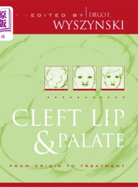海外直订医药图书Cleft Lip and Palate 唇腭裂
