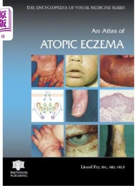 海外直订医药图书An Atlas of Atopic Eczema 特应性湿疹图集