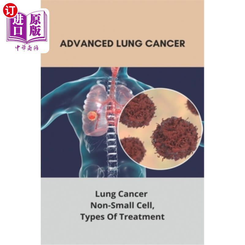 海外直订医药图书Advanced Lung Cancer: Lung Cancer - Non-Small Cell, Types Of Treatment: Lung Can 晚期肺癌:肺癌-非