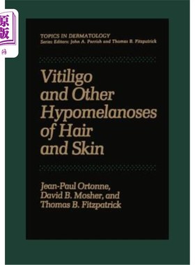 海外直订医药图书Vitiligo and Other Hypomelanoses of Hair and Skin 白癜风和其他头发和皮肤黑色素沉着症