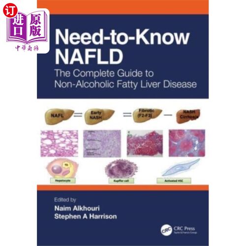 海外直订医药图书Need-to-Know NAFLD 应非酒精性脂肪肝