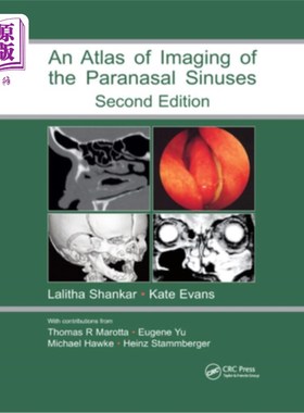 海外直订医药图书An Atlas of Imaging of the Paranasal Sinuses 副鼻窦成像图集