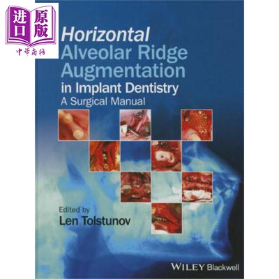 种植牙中的水平牙槽嵴 Horizontal Alveolar Ridge Augmentation Implant Dentistry Len Tolstunov 英文原版【中商原版】wil