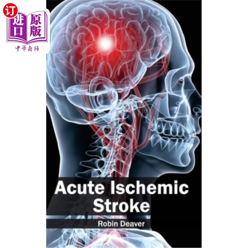 海外直订医药图书Acute Ischemic Stroke 急性缺血性中风