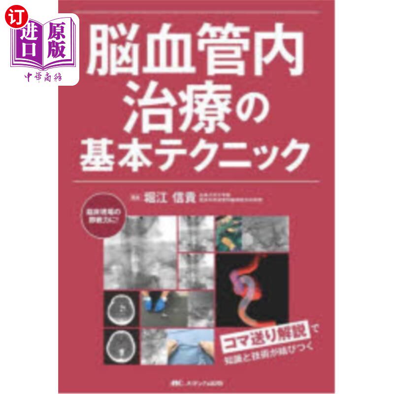 海外直订日语 脳血管内治療の基本テクニック 脳血管内治療の基本テクニック