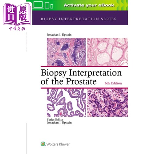 现货 前列腺活检解读 第6版 英文原版 Biopsy Interpretation of the Prostate  Biopsy Interpretation Series 【中商原版】
