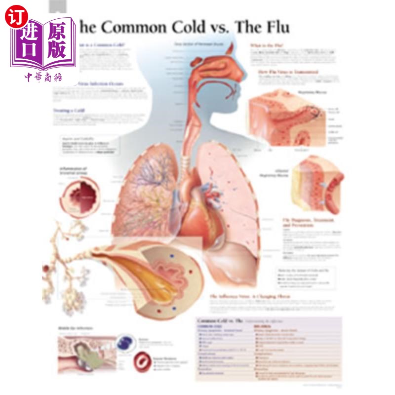 海外直订医药图书The Common Cold Vs Flu Chart: Wall Chart 普通感冒与流感图表：挂图