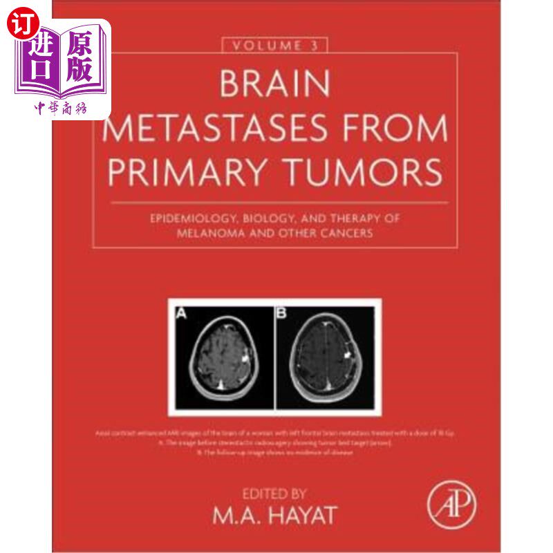 海外直订医药图书Brain Metastases from Primary Tumors, Volume 3: Epidemiology, Biology, and Thera 来自原发肿瘤的脑转