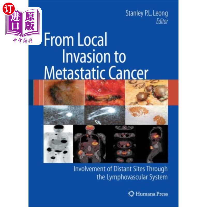 海外直订医药图书From Local Invasion to Metastatic Cancer 从局部浸润到转移性癌症