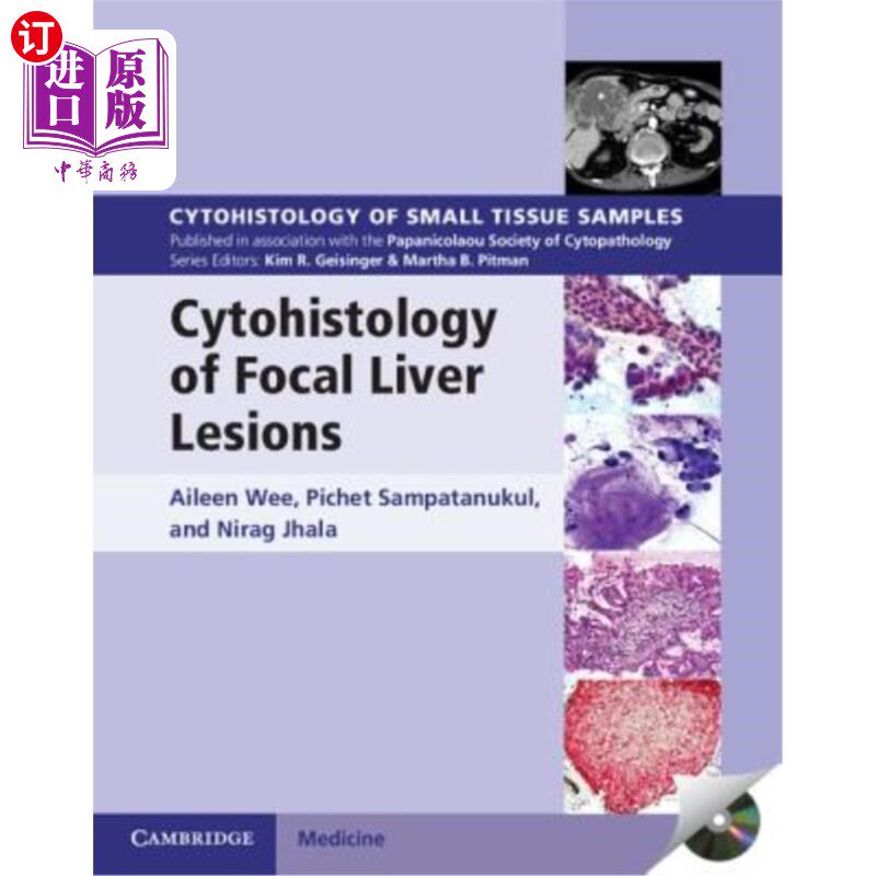 海外直订医药图书Cytohistology of Focal Liver Lesions 肝脏局灶性病变的细胞组织学