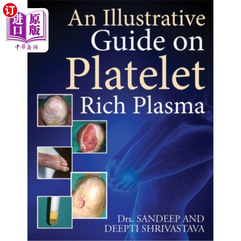 海外直订医药图书An Illustrative Guide on Platelet Rich Plasma富血小板血浆说明性指南