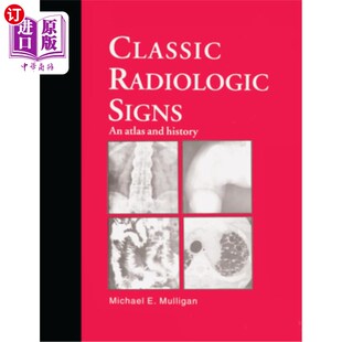 Atlas 放射学征象 Radiologic 图集与历史 经典 Signs History 海外直订医药图书Classic and