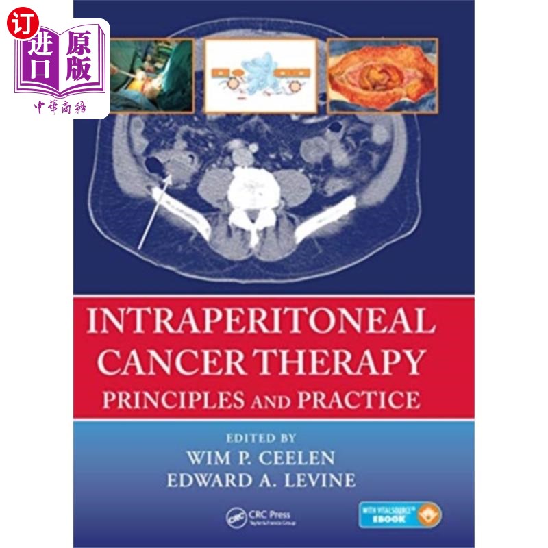 海外直订医药图书Intraperitoneal Cancer Therapy 腹腔癌症治疗